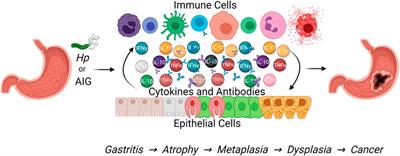 Two Distinct Etiologies of Gastric Cancer: Infection and Autoimmunity